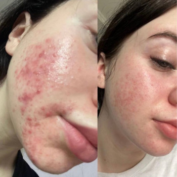 Гюльнара Фаттаева, Moscow Фото - 5