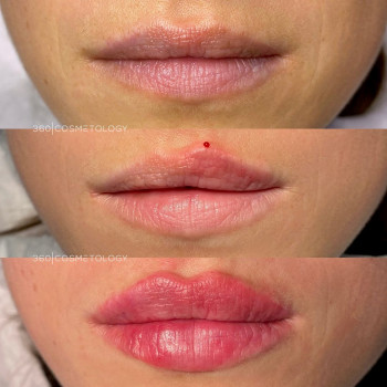 Ирина Филимоненко, Moscow Фото - 5