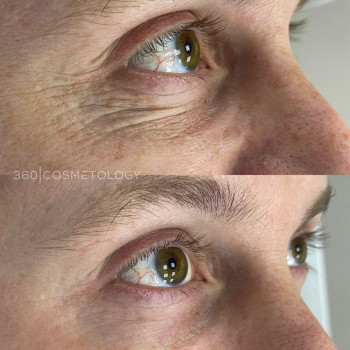 Ирина Филимоненко, Moscow Фото - 6