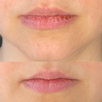 Александра Деньгина, Москва Фото - 5