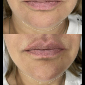 Анна Самбук, Moscow Фото - 5