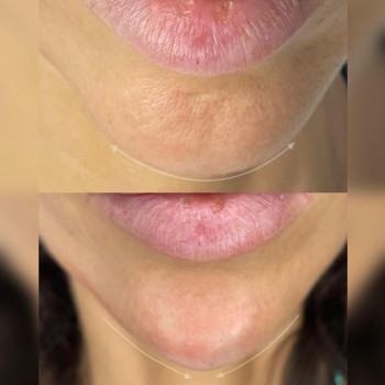 Анна Самбук, Moscow Фото - 6