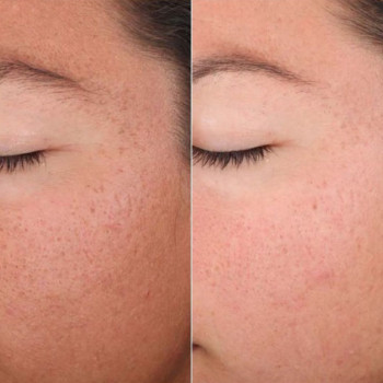 Татьяна Соболева, Moscow Фото - 5