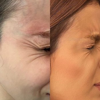 Лиана Абрамян, Moscow Фото - 5