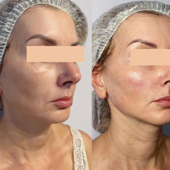 Елизавета Дубинская, Москва Фото - 5