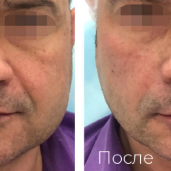 EverEsthetic, Moscow Фото - 5