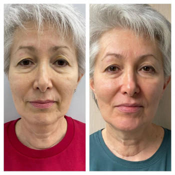 Мадина Колиева, Moscow Фото - 5