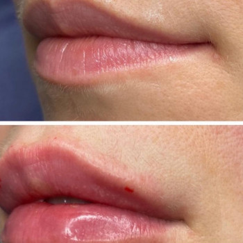 Ирина Лепешинская, Moscow Фото - 5