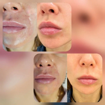 Ирина Гузева, Москва Фото - 5