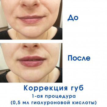 Светлана Ремизова, Moscow Фото - 5