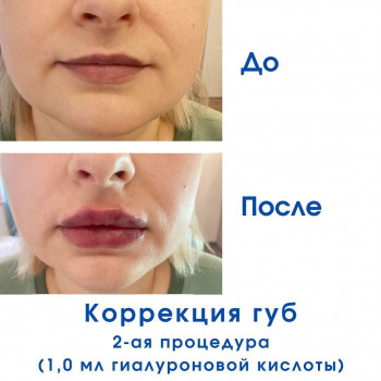 Светлана Ремизова, Moscow Фото - 6