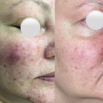 Тина Цховребова, Moscow Фото - 5