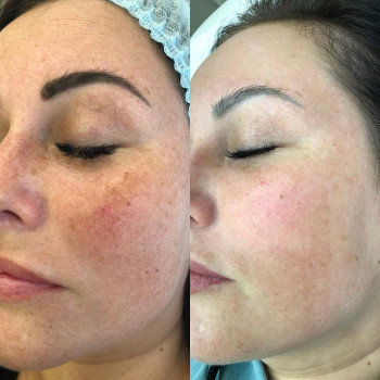 Тина Цховребова, Moscow Фото - 7