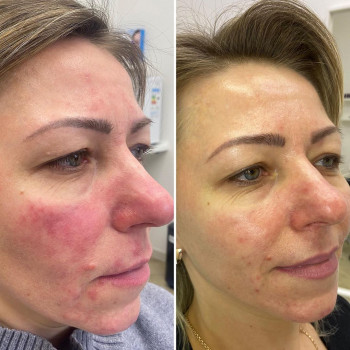 Inside Beauty  Clinic, Moscow Фото - 5