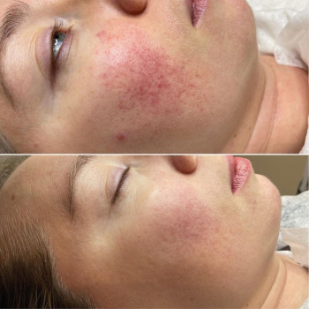 Inside Beauty  Clinic, Moscow Фото - 6