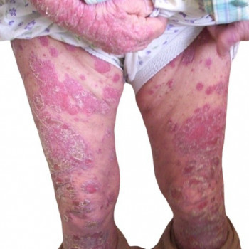 Дмитрий Серов, Khimki Фото - 5