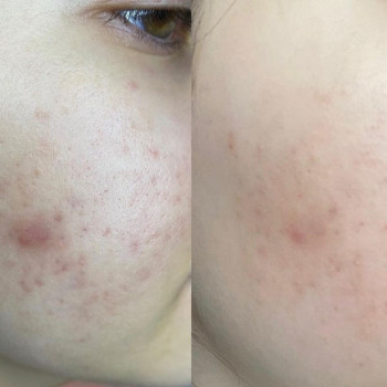 Диана Сипунова, Moscow Фото - 5