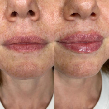 Диана Сипунова, Moscow Фото - 6