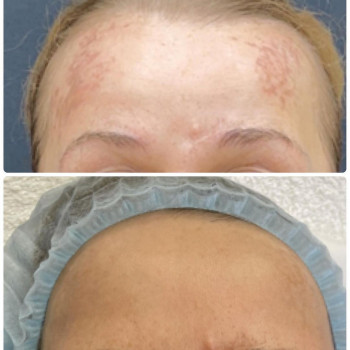 Инна Гуцал, Moscow Фото - 5