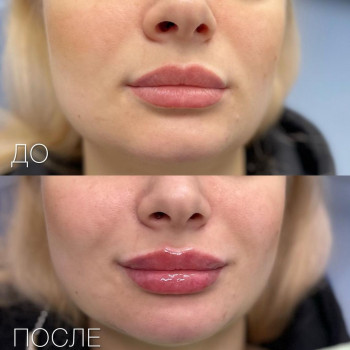 Елена Мартиросян, Moscow Фото - 5