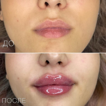 Елена Мартиросян, Moscow Фото - 6