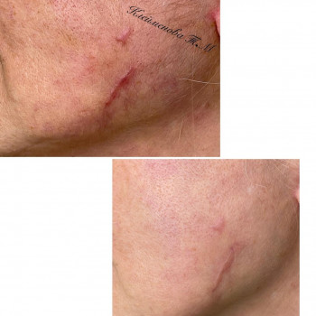 Татьяна Клейменова, Moscow Фото - 6