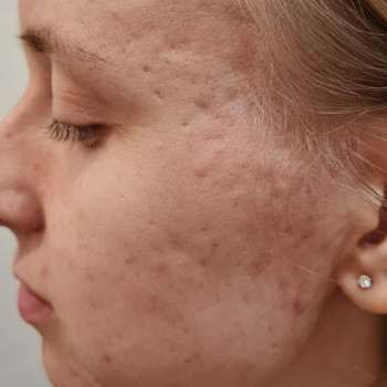 Лилия Фатехова, Moscow Фото - 5