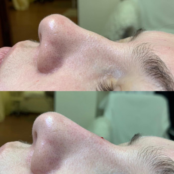 Ирина Бетина, Москва Фото - 5