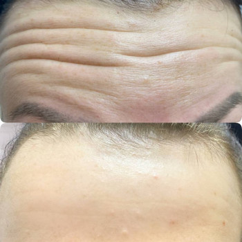 Наталья Ворожко, Moscow Фото - 7