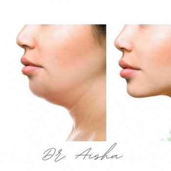 Аиша , Moscow Фото - 5