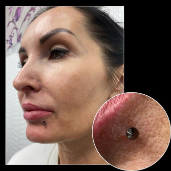 Альбина , Moscow Фото - 5