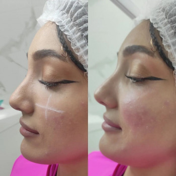 Лейли Рустамова, Moscow Фото - 5