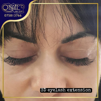 Onail, Краби Фото - 6