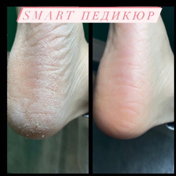 Маникюр и педикюр
                    Maniküre Анастасия  Rostov-on-Don