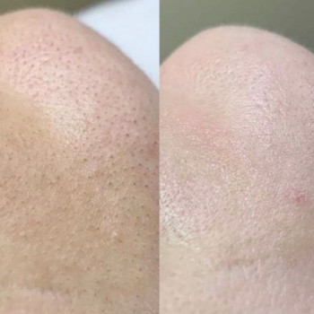 Клиника косметологии Beautera, Ufa Фото - 6