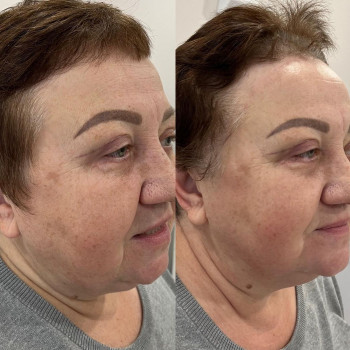 Клиника косметологии Beautera, Ufa Фото - 7