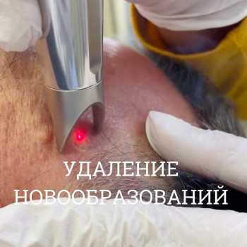 Виктория Никурадзе, Moscow Фото - 6