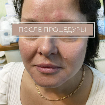 Ольга Ломовцева, Odintsovo Фото - 5