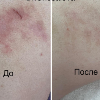 Елена Чесалова, Moscow Фото - 5