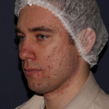 Айшат Махулаева, Moscow Фото - 6