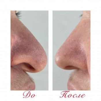 Наталия Гринь, Moscow Фото - 5