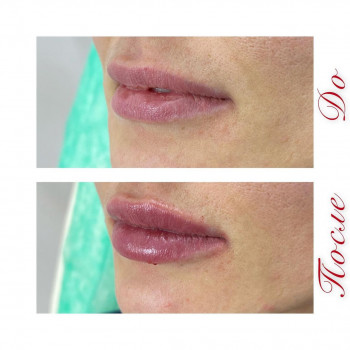 Наталия Гринь, Moscow Фото - 6