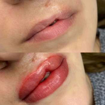 Валерия Воронова, Shchyolkovo Фото - 18