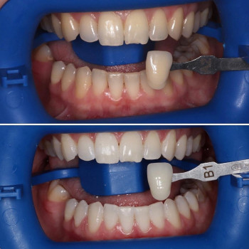 Dentis, Москва Фото - 5