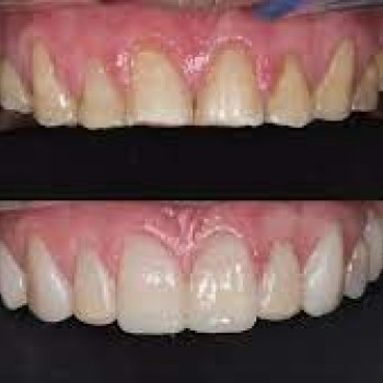 Филигранно, Moscow Фото - 5