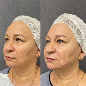 Татьяна Кичкина, Krasnogorsk Фото - 5