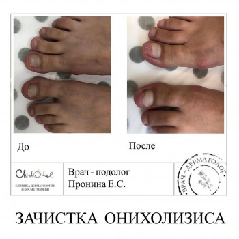 Chistotel, Moscow Фото - 5