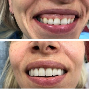 Dentium, Moscow Фото - 5