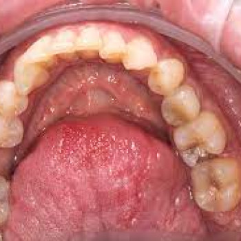 Акула дент, Moscow Фото - 5