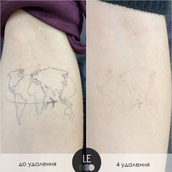 Lasereffect, Moscow Фото - 5